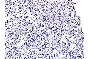Immunohistochemistry (IHC) image for anti-Wingless-Type MMTV Integration Site Family, Member 3A (WNT3A) (AA 281-352) antibody (ABIN733178)