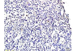 Formalin-fixed and paraffin embedded rat periodontitis tissue labeled with Anti-Wnt3a Polyclonal Antibody , Unconjugated at 1:300 followed by conjugation to the secondary antibody, (SP-0023) , and DAB staining (WNT3A 抗体  (AA 281-352))
