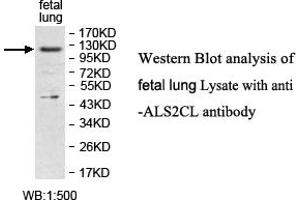 Image no. 1 for anti-ALS2 C-terminal Like (ALS2CL) antibody (ABIN1574646) (ALS2CL 抗体)