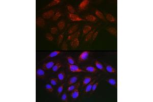 Immunofluorescence analysis of U2OS cells using Cytochrome C Rabbit pAb (ABIN3020718, ABIN3020719, ABIN3020720, ABIN1512803 and ABIN6213689) at dilution of 1:150 (40x lens). (Cytochrome C 抗体  (AA 1-105))