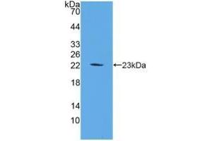 Detection of Recombinant FGF6, Mouse using Polyclonal Antibody to Fibroblast Growth Factor 6 (FGF6) (FGF6 抗体  (AA 39-208))