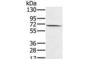 Western Blot analysis of Hela cell using HSF2 Polyclonal Antibody at dilution of 1:550 (HSF2 抗体)
