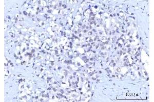IHC analysis of RBM15B using anti-RBM15B antibody (ABIN7600219). (RBM15B 抗体  (AA 164-890))