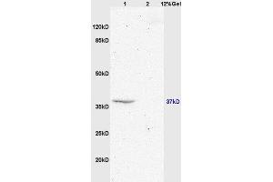 Lane 1: mouse brain lysates Lane 2: mouse embryo lysates probed with Anti GPR55 Polyclonal Antibody, Unconjugated  at 1:200 in 4˚C.