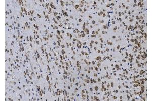 IHC analysis of Gpnmb using anti-Gpnmb antibody (ABIN7600217). (Osteoactivin 抗体  (AA 164-564))