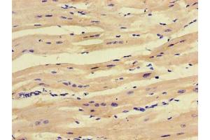 Immunohistochemistry of paraffin-embedded human heart tissue using ABIN7166097 at dilution of 1:100 (SCO1 抗体  (AA 29-176))