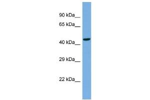 Host:  Rabbit  Target Name:  TBC1D22A  Sample Type:  NCI-H226 Whole cell lysates  Antibody Dilution:  1.
