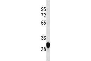 PLP antibody western blot analysis in HeLa lysate (PLP1 抗体  (AA 248-277))