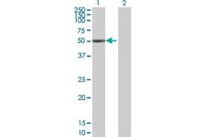 Western Blot analysis of ALDH1A1 expression in transfected 293T cell line by ALDH1A1 MaxPab polyclonal antibody.