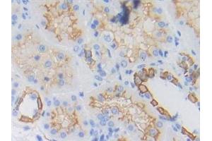 Detection of CYFRA21-1 in Human Kidney Tissue using Polyclonal Antibody to Cytokeratin Fragment Antigen 21-1 (CYFRA21-1) (CYFRA21.1 抗体  (AA 244-400))
