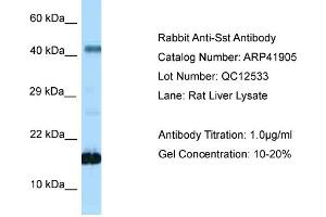 Host: Rabbit Target Name: SST Sample Tissue: Rat Liver Antibody Dilution: 1ug/ml (Somatostatin 抗体  (N-Term))