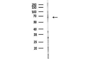 anti-RNA Binding Motif Protein 47 (RBM47) antibody