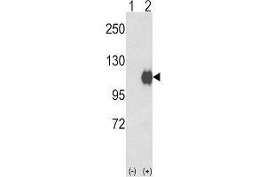 Western Blotting (WB) image for anti-Ectonucleotide Pyrophosphatase/phosphodiesterase 2 (ENPP2) antibody (ABIN2927789) (ENPP2 抗体)