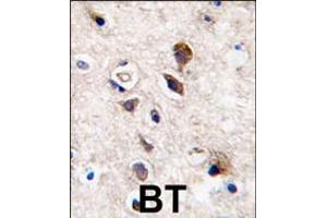 Formalin-fixed and paraffin-embedded human brain tissue reacted with PKC gamma antibody , which was peroxidase-conjugated to the secondary antibody, followed by DAB staining. (PKC gamma 抗体  (C-Term))