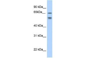 Western Blot showing RBM35B antibody used at a concentration of 1-2 ug/ml to detect its target protein. (ESRP2 抗体  (N-Term))