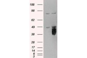Western Blotting (WB) image for anti-Tissue Factor Pathway Inhibitor (Lipoprotein-Associated Coagulation Inhibitor) (TFPI) (C-Term) antibody (ABIN2465317) (TFPI 抗体  (C-Term))