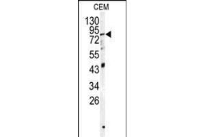 Western blot analysis of PSS1 antibody (N-term K9) (ABIN1882107 and ABIN2839313) in CEM cell line lysates (35 μg/lane). (PAPSS1 抗体  (N-Term))
