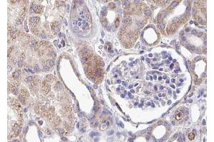 ABIN6267421 at 1/100 staining human kidney tissue sections by IHC-P. (Phospholipase C gamma 1 抗体  (pTyr783))