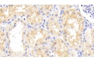 Detection of PARK7 in Human Kidney Tissue using Polyclonal Antibody to Parkinson Disease Protein 7 (PARK7) (PARK7/DJ1 抗体  (AA 1-189))