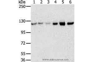 Western blot analysis of 823, A549, K562, 293T, hepg2 and huvec cell, using RBM5 Polyclonal Antibody at dilution of 1:450 (RBM5 抗体)