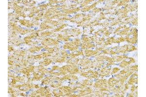 Immunohistochemistry (IHC) image for anti-Aconitase 2, Mitochondrial (ACO2) (AA 501-780) antibody (ABIN1678537)