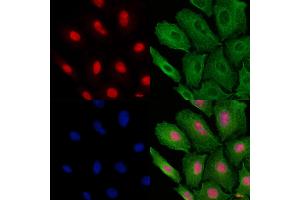 ABIN6257409 and ABIN6273693 staining  cells by IF/ICC.