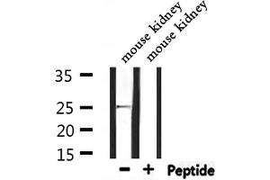 Western blot analysis of extracts from mouse kidney, using RAB32 Antibody. (RAB32 抗体  (C-Term))