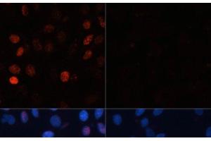 Immunofluorescence analysis of C6 cells using Phospho-γH2A. (gamma H2AX 抗体  (pSer139))