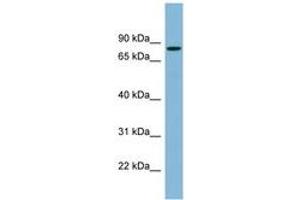Image no. 1 for anti-Erythrocyte Membrane Protein Band 4.1 (Elliptocytosis 1, RH-Linked) (EPB41) (AA 107-156) antibody (ABIN6742061) (EPB41 抗体  (AA 107-156))