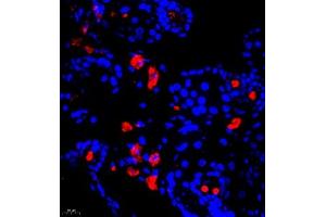 Immunofluorescence of paraffin embedded mouse breast using Calcitonin (ABIN7073271) at dilution of 1:650 (400x lens) (Calcitonin 抗体)