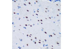 Immunohistochemistry (IHC) image for anti-Paraspeckle Component 1 (PSPC1) (AA 1-70) antibody (ABIN6146363)