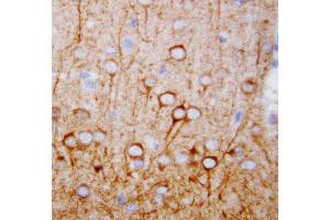 Anti-CaMKK antibody, IHC(P) IHC(P): Rat Brain Tissue (CAMKK1 抗体  (N-Term))