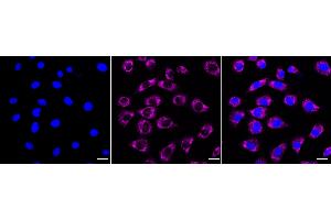 anti-Metadherin (MTDH) antibody