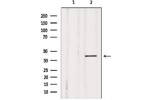 Western blot analysis of extracts from Mouse cancer, using MKP-2 Antibody. (DUSP4 抗体  (Internal Region))