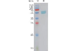 SDS-PAGE (SDS) image for Interferon, alpha 2 (IFNA2) (AA 24-188) protein (Fc Tag) (ABIN7538336)