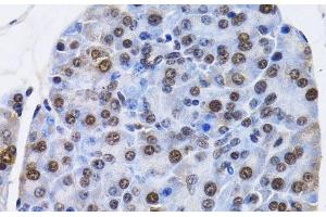 Immunohistochemistry of paraffin-embedded Mouse pancreas using ID3 Polyclonal Antibody at dilution of 1:200 (40x lens). (ID3 抗体)