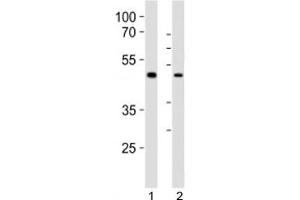 Western blot analysis of lysate from 1) human LNCaP and 2) mouse F9 cell line using Sox17 antibody at 1:1000. (SOX17 抗体  (C-Term))
