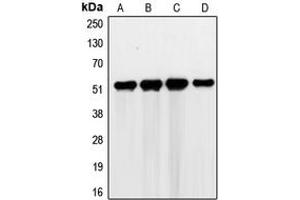 Western blot analysis of G3BP2 expression in HEK293T (A), RT4 (B), Jurkat (C), K562 (D) whole cell lysates. (G3BP2 抗体  (C-Term))