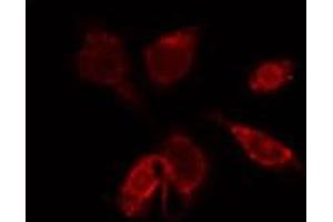 ABIN6274000 staining HepG2 by IF/ICC. (CCR9 抗体  (C-Term))