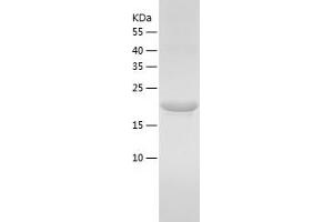 Western Blotting (WB) image for Major Urinary Protein 20 (MUP20) (AA 20-181) protein (His tag) (ABIN7123831) (Mup20 Protein (AA 20-181) (His tag))