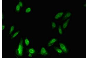 Immunofluorescent analysis of Hela cells using ABIN7155905 at dilution of 1:100 and Alexa Fluor 488-congugated AffiniPure Goat Anti-Rabbit IgG(H+L) (LIPE 抗体  (AA 1-251))