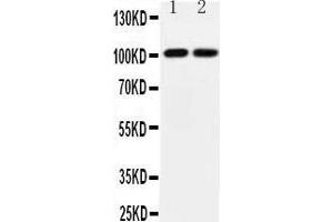Observed bind size: 101KD (Glutamate Receptor 3 抗体  (Middle Region))