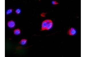 IF analysis of MEK2/MAP2K2 using anti-MEK2/MAP2K2 antibody (ABIN7599357). (MEK2 抗体  (AA 1-400))