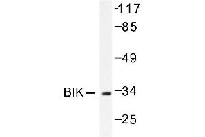 Image no. 1 for anti-BCL2-Interacting Killer (Apoptosis-Inducing) (BIK) antibody (ABIN265329) (BIK 抗体)