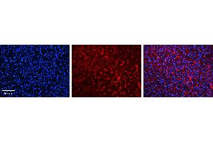 RHOD antibody - C-terminal region          Formalin Fixed Paraffin Embedded Tissue:  Human Liver Tissue    Observed Staining:  Cytoplasm in sinusoids of liver   Primary Antibody Concentration:  1:100    Other Working Concentrations:  1/600    Secondary Antibody:  Donkey anti-Rabbit-Cy3    Secondary Antibody Concentration:  1:200    Magnification:  20X    Exposure Time:  0. (RHOD 抗体  (C-Term))