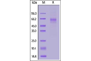 Human LIV-1, His Tag on  under reducing (R) condition. (SLC39A6 Protein (AA 29-325) (His tag))