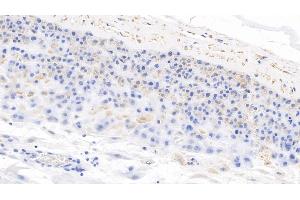Detection of NT-ProBNP in Human Placenta Tissue using Polyclonal Antibody to N-Terminal Pro-Brain Natriuretic Peptide (NT-ProBNP)