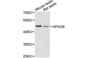 Western blot analysis of extracts of various cell lines, using SPAG8 antibody. (SPAG8 抗体)