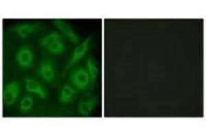 Immunofluorescence analysis of HeLa cells, using CDH23 antibody. (CDH23 抗体)