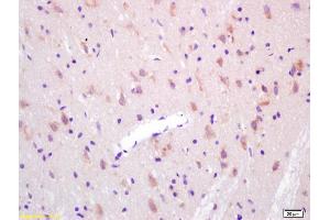 Formalin-fixed and paraffin embedded rat brain labeled with Anti-KAT2B/ GCN5/PCAF Polyclonal Antibody, Unconjugated (ABIN755287) at 1:200 followed by conjugation to the secondary antibody and DAB staining. (KAT2B 抗体  (AA 451-550))